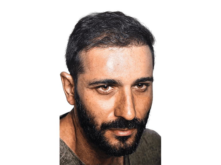 Full Face 0001 – After