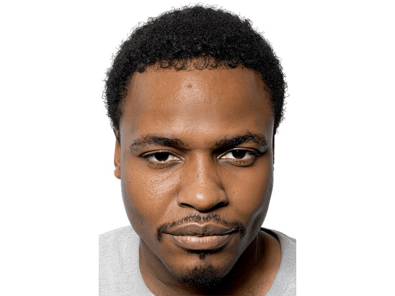 Full Face 0002 – After