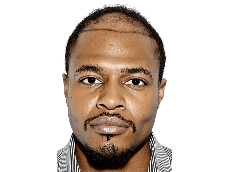 Full Face 0002 – Before