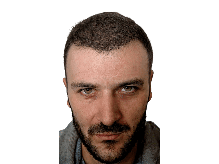 Full Face 0010 – After