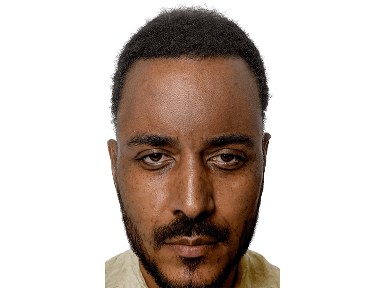 Full Face 0024 – After