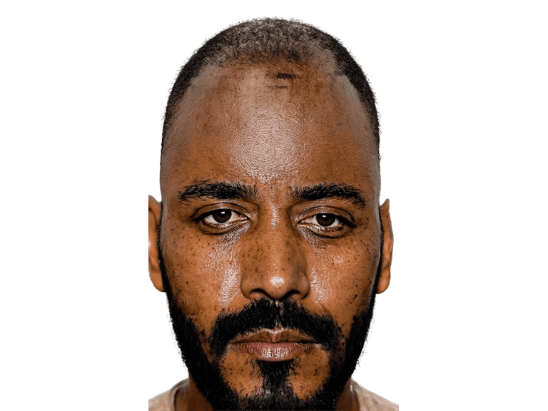 Full Face 0024 – Before