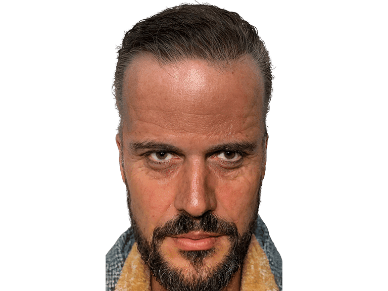 Full Face 0025 – After