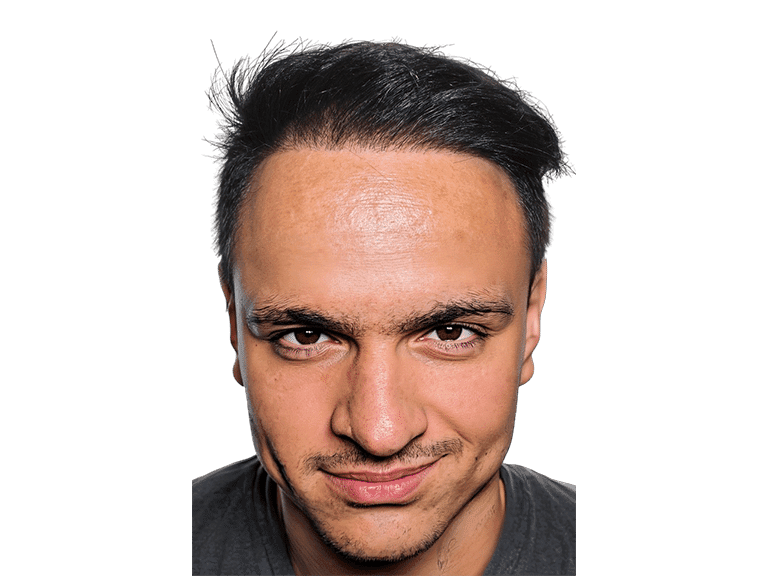 Full Face 0026 – After