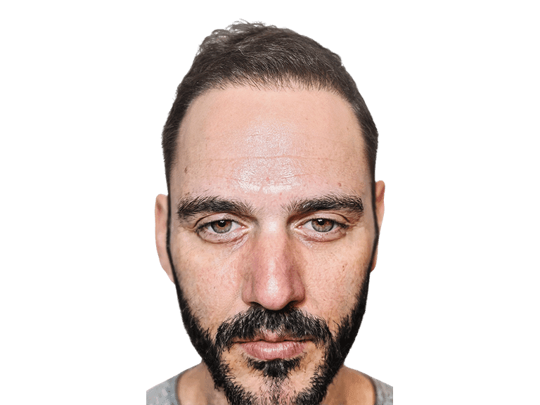 Full Face 0027 – After