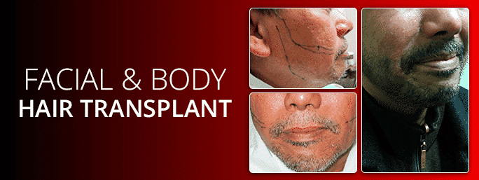 Effective Facial Body Hair Transplants Maxim Hair Restoration