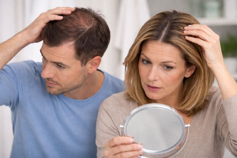 Couple examining thinning hair in mirror before considering non surgical hair restoration options