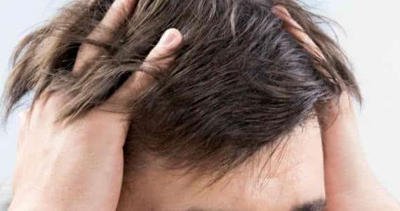 how to stop hair loss