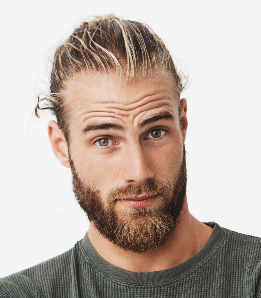 facial hair transplant