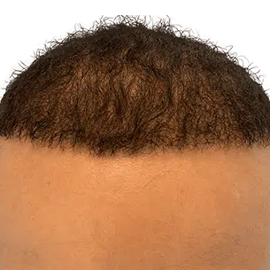 Before After 1