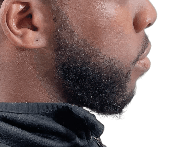 Well-groomed beard on African American man. Hair restoration results? Consider a beard transplant for similar density.