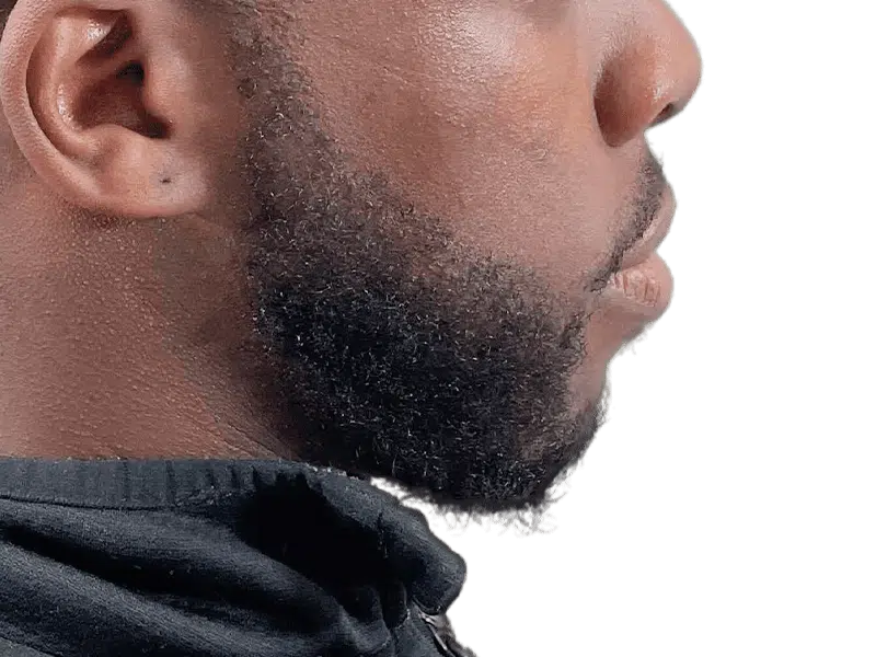 Well-groomed beard on African American man. Hair restoration results? Consider a beard transplant for similar density.