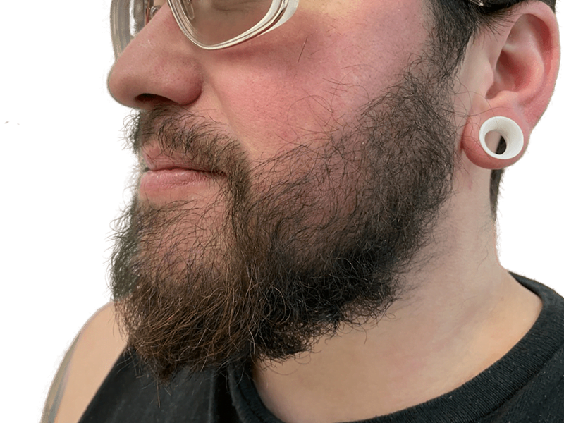 Full, dark beard on a man with thick hair. Example of natural hair growth, not a hair transplant result. White ear gauge visible.