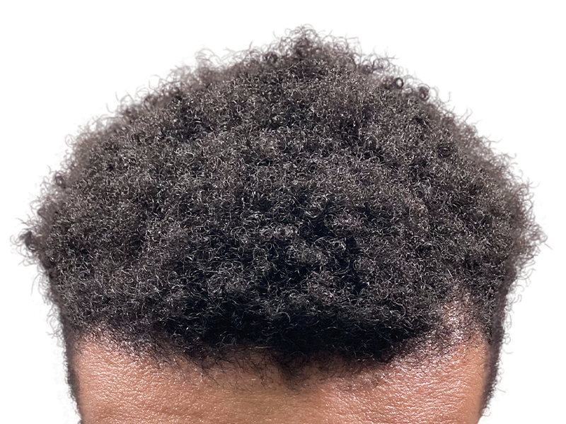 Close-up of dark, curly hair. No visible hair transplant. Natural hair density. Not a before/after hair restoration result.