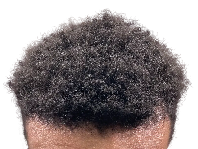 Close-up of dark, curly hair. No visible hair transplant. Natural hair density. Not a before/after hair restoration result.