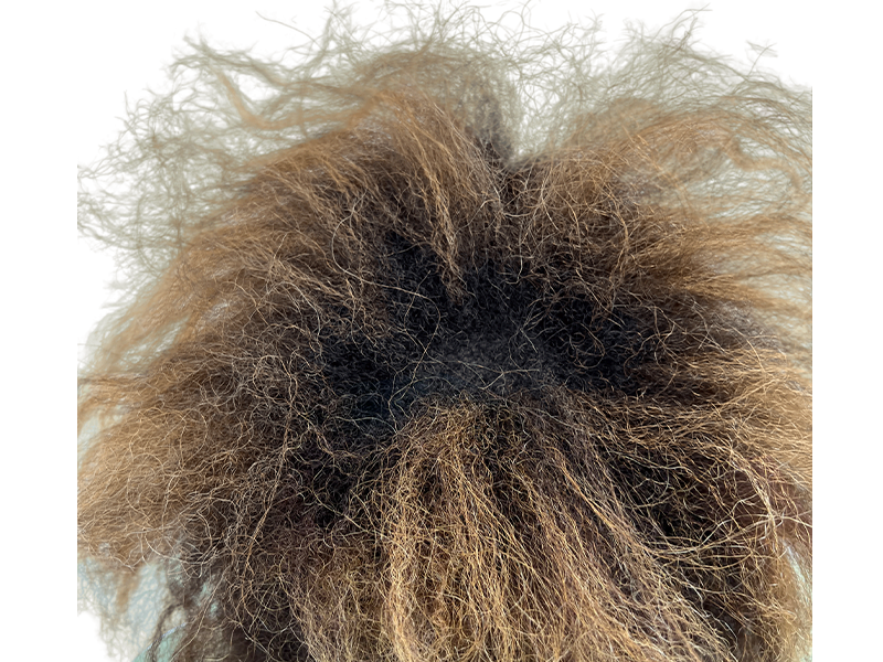Before hair transplant: Thinning, curly brown hair. Consider hair restoration options for fuller hair.