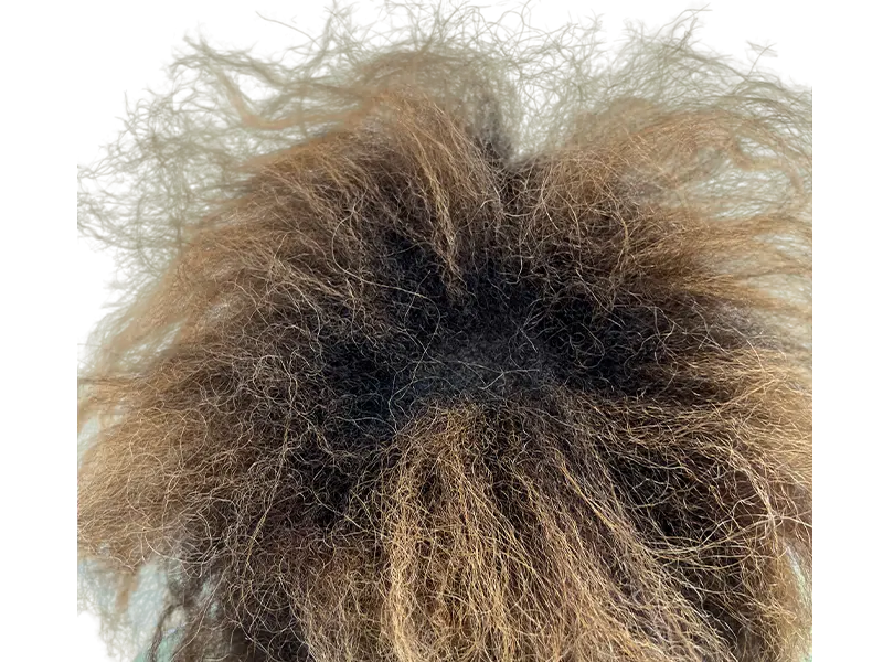 Before hair transplant: Thinning, curly brown hair. Consider hair restoration options for fuller hair.