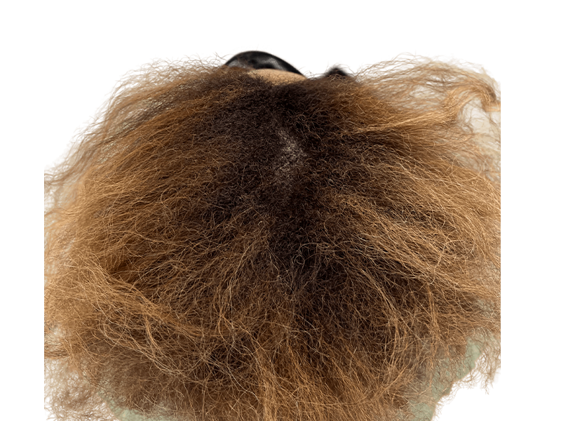 Thinning crown hair. Potential hair restoration candidate. Hair transplant before photo? Dark brown to golden brown hair.