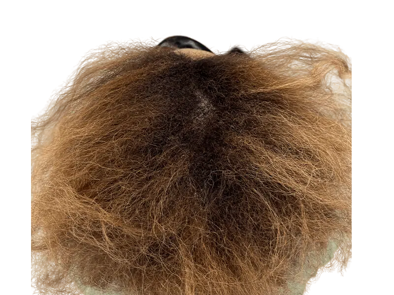 Thinning crown hair. Potential hair restoration candidate. Hair transplant before photo? Dark brown to golden brown hair.