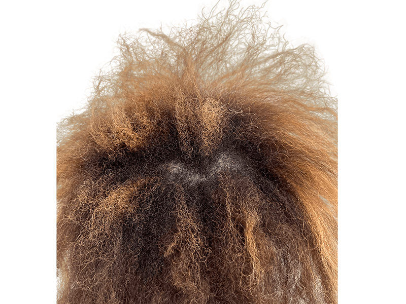 Hair restoration results: Textured hair with highlights. Potential hair transplant before/after. Crown hair detail.