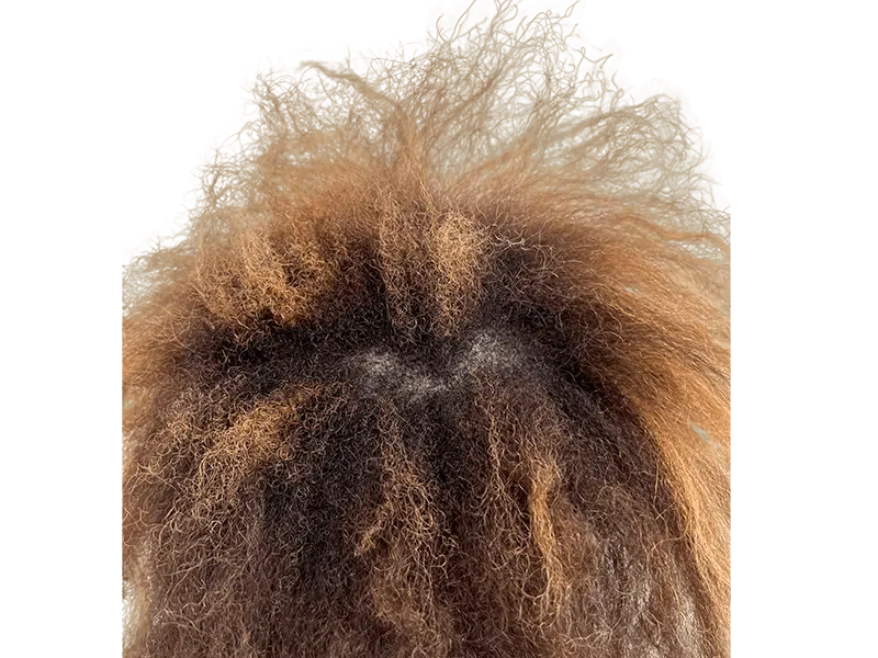 Hair restoration results: Textured hair with highlights. Potential hair transplant before/after. Crown hair detail.