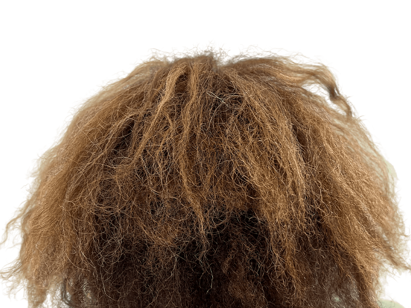 Dense, light brown hair. Potential hair transplant result. Textured, natural look. Hair restoration services.
