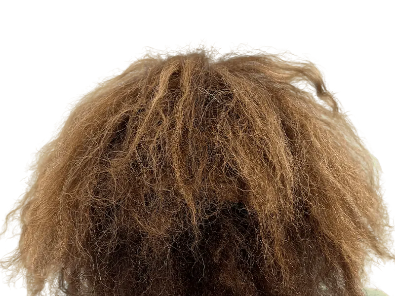 Dense, light brown hair. Potential hair transplant result. Textured, natural look. Hair restoration services.