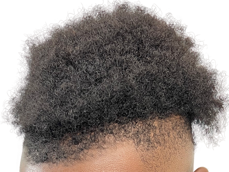 Dense, natural black hair. Healthy scalp, no visible signs of hair loss or transplant. Hair restoration potential.