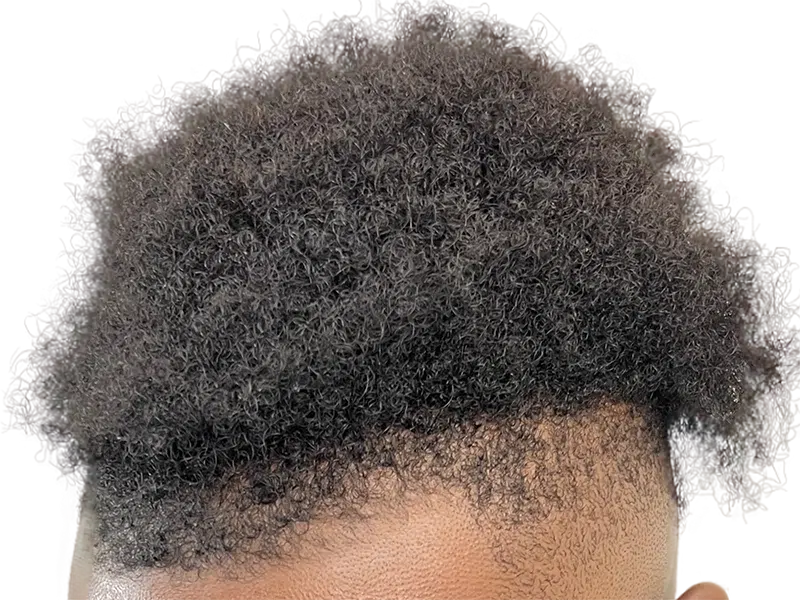 Dense, natural black hair. Healthy scalp, no visible signs of hair loss or transplant. Hair restoration potential.