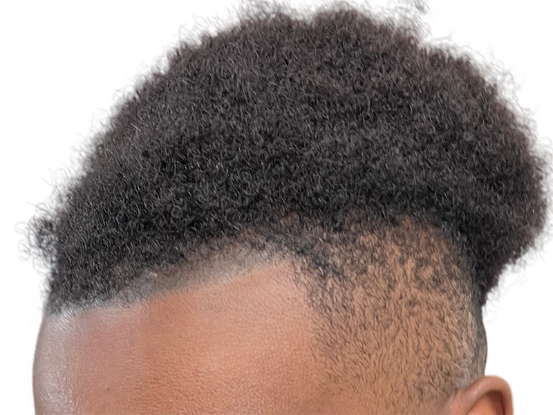 Close-up: Neat, short black hair. Hair restoration/transplant candidate? Healthy scalp, no visible procedure.