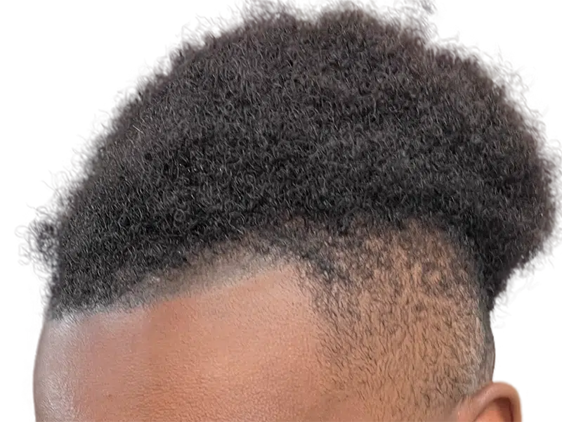 Close-up: Neat, short black hair. Hair restoration/transplant candidate? Healthy scalp, no visible procedure.