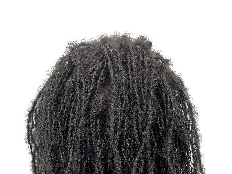 Thick dreadlocks. Could be achieved with hair restoration. No transplant visible. Focus on texture and volume.