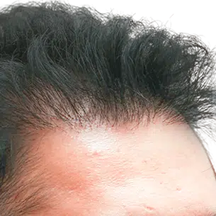 Before After 3