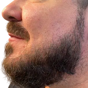 Before After 3