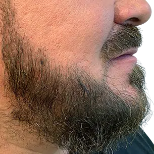 Before After 1