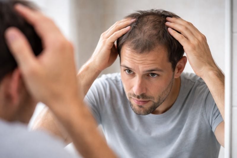 Man checking thinning hair, questioning how much hair loss is normal
