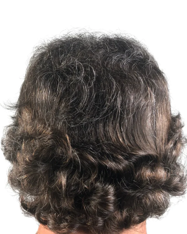 Crown hair loss has a sneaky way of making you look older than you actually are. As the hair thins at the top, more scalp starts to show, throwing off the natural balance and fullness of your look. It subtly reshapes your head’s profile, giving it a flatter, more aged appearance—even if your face is youthful and full of energy. Unlike a receding hairline, which can sometimes be styled around, crown thinning is harder to hide and often more noticeable from everyday angles—like in photos, under lights, or from behind. It creates a quiet but powerful impression of age, adding years without you even realizing it.