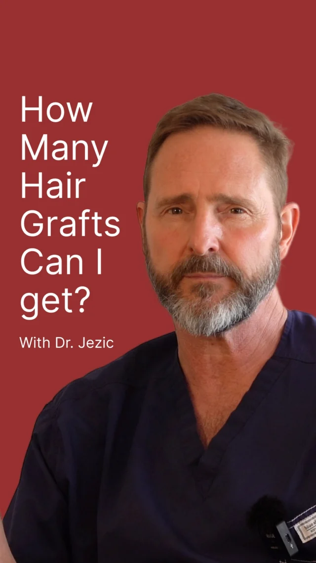 Wondering how many hair grafts you can get with Dr. Jezic, the world-renowned celebrity hair transplant doctor? Dr. Jezic specializes in personalized, high-density hair restoration procedures tailored to each individual’s needs. During your consultation, he’ll assess your hair loss pattern and donor area to determine the optimal number of grafts for natural, lasting results.