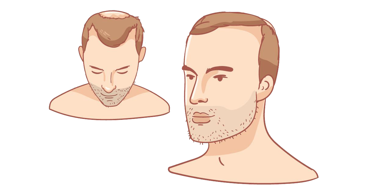 HAIR TRANSPLANT SURGERY VS NON-SURGICAL HAIR LOSS SOLUTIONS