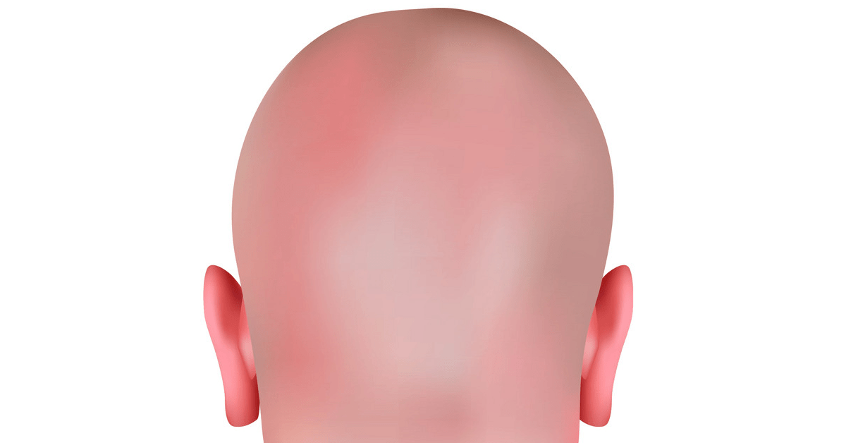 WHAT IS SCALP MICROPIGMENTATION?