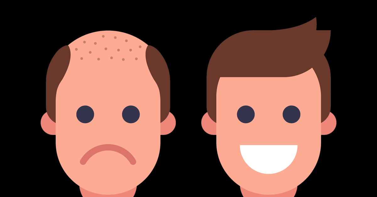 How does a hair transplant work?