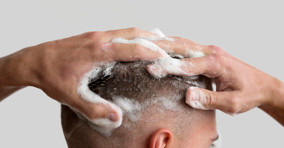 IS SHAMPOO CAUSING YOUR HAIR LOSS?