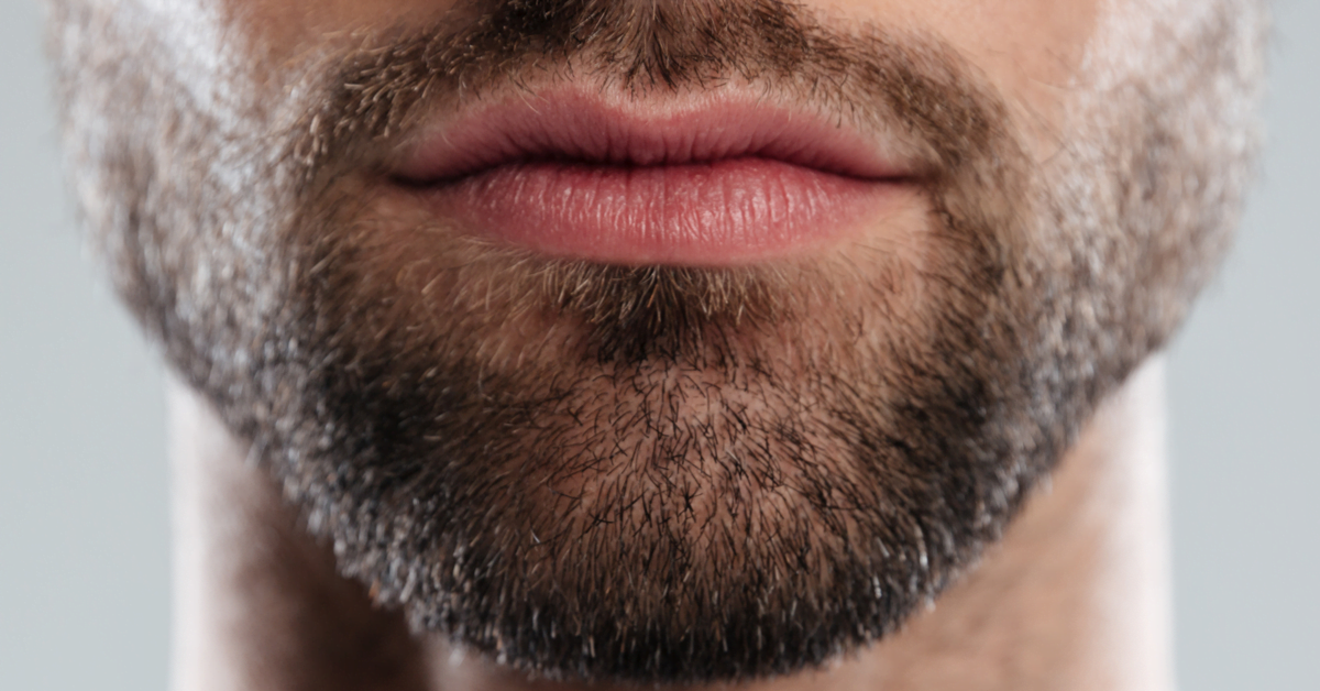 What Is A Facial Hair Transplant?