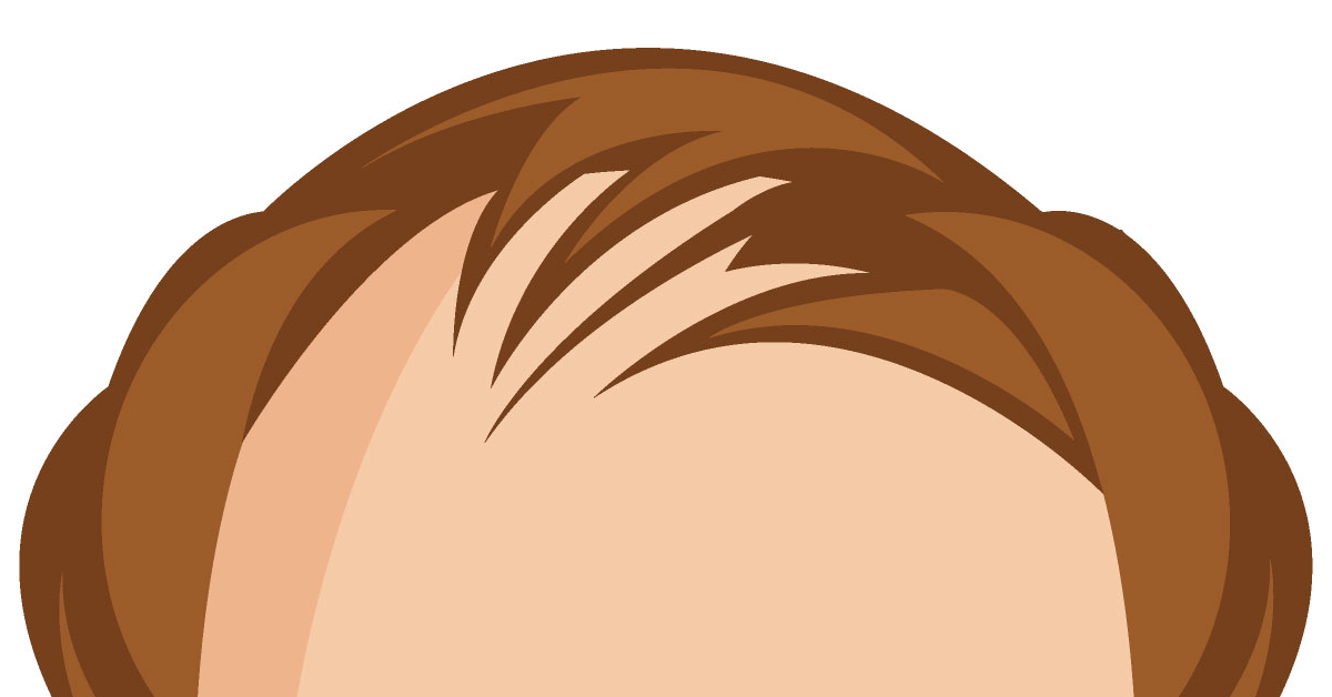 Is hair loss reversible?