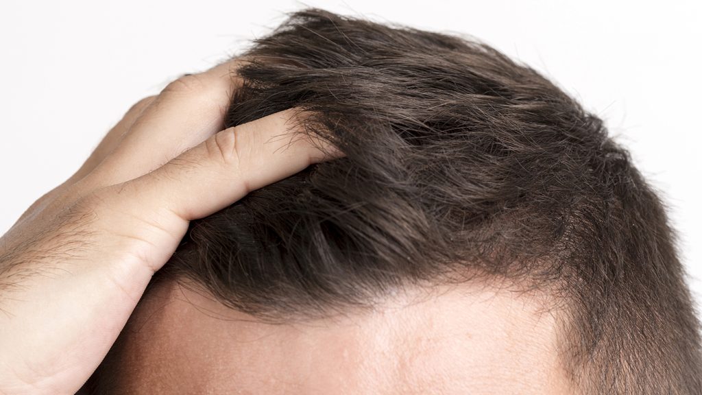 facts about hair transplant