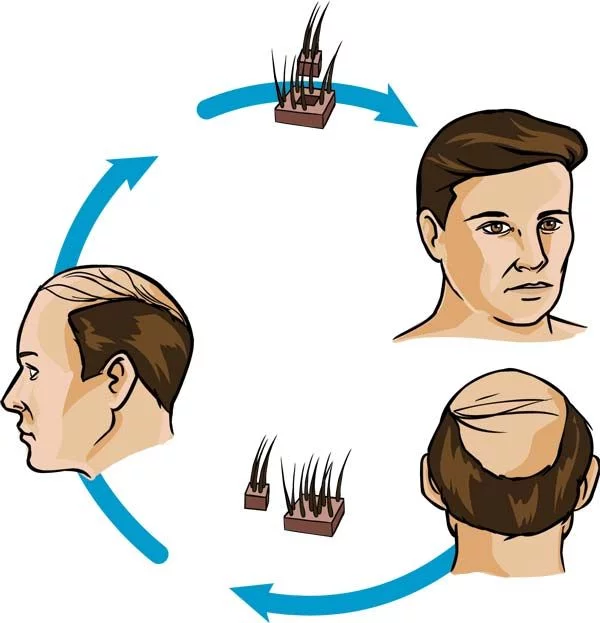 Haarstöpsel Behandlung Haarwiederherstellung Dienstleistungen maxim