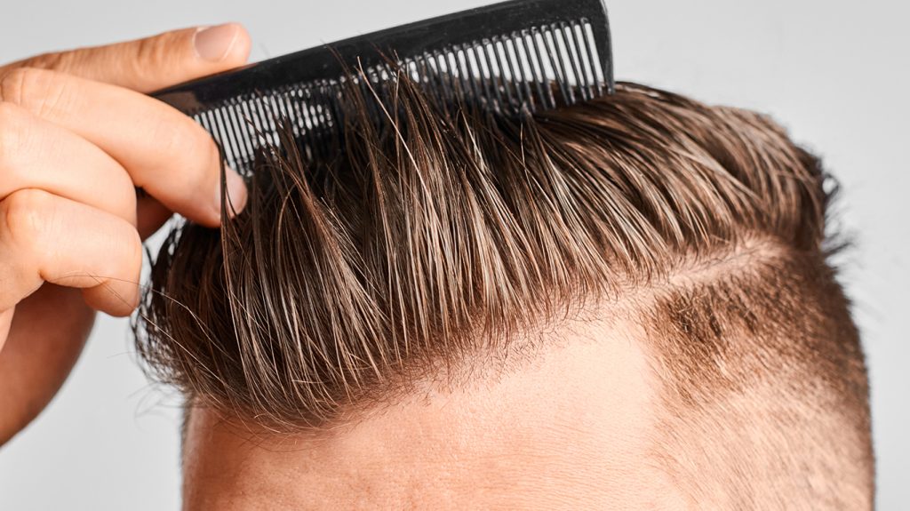 Man Combing Hair - In Dept Look at FUT Hair Transplants