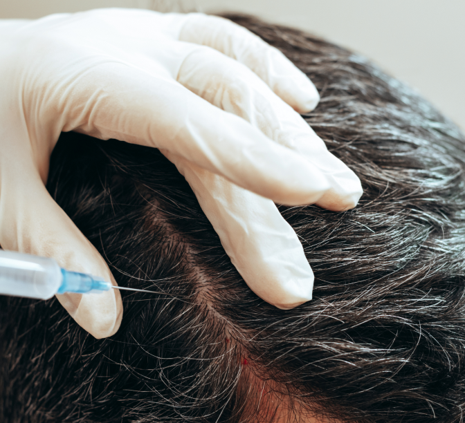scalp injection