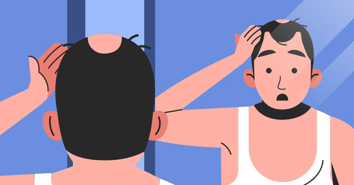 IS THERE A CONNECTION BETWEEN MASTURBATION AND HAIR LOSS?
