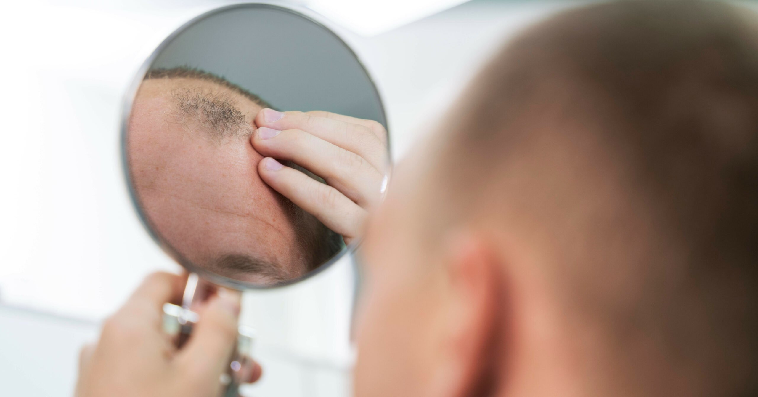 THE COMPREHENSIVE GUIDE TO CHOOSING THE MOST EFFECTIVE MEDICATIONS FOR COMBATING HAIR LOSS